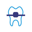 Ortodoncia Convencional